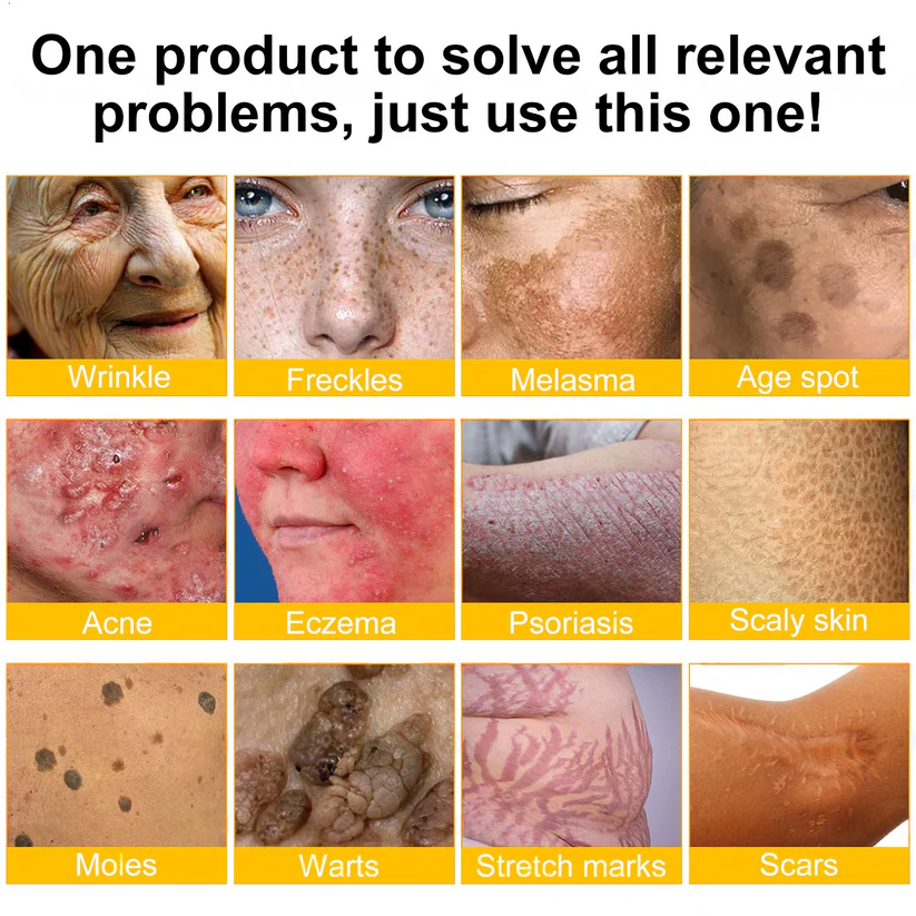 💕FDA Approved:  Bee venom Pro Comprehensive Cream — 🔥Limited Time 80% OFF🔥