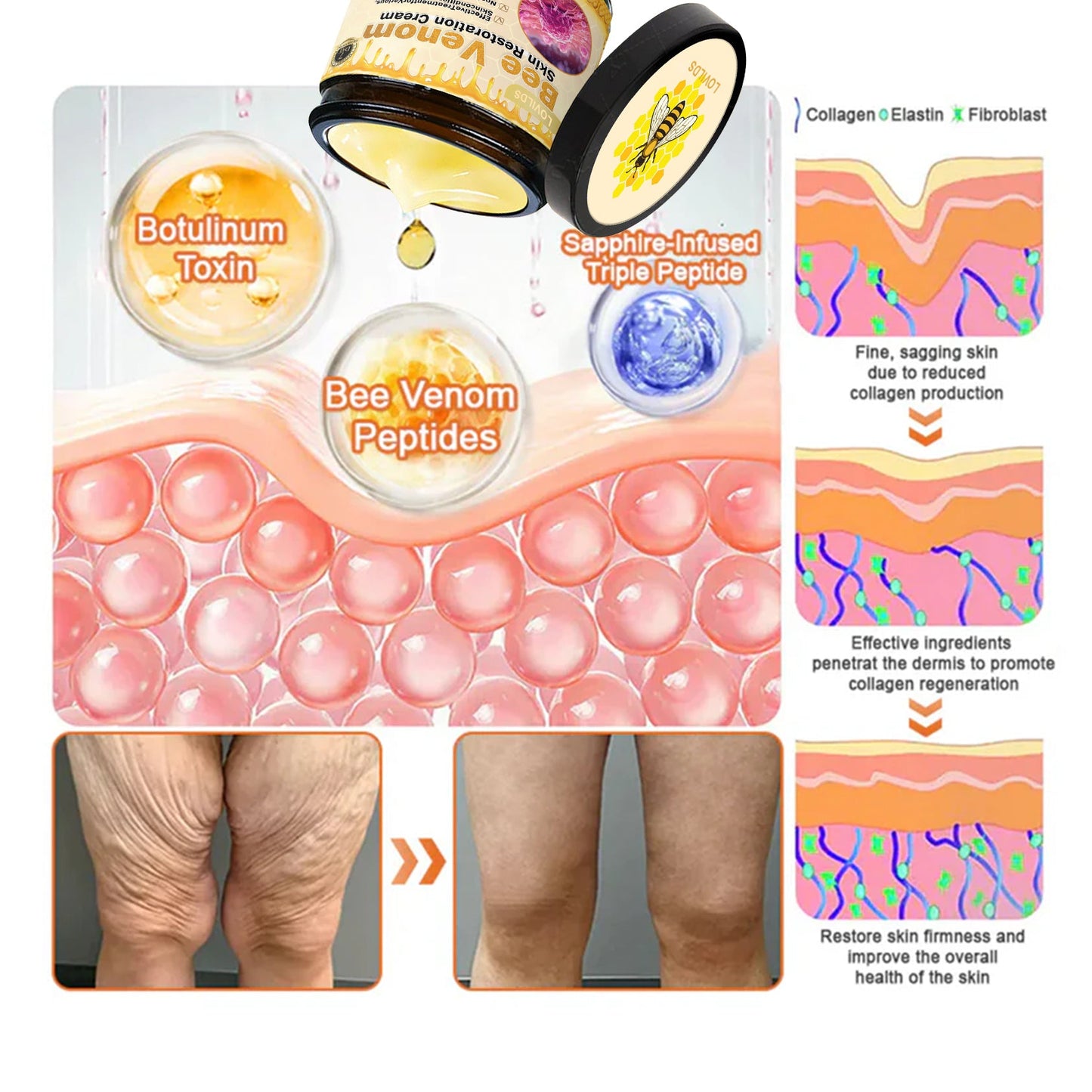 💕FDA Approved:  Bee venom Pro Comprehensive Cream — 🔥Limited Time 80% OFF🔥