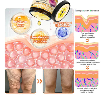 💕FDA Approved:  Bee venom Pro Comprehensive Cream — 🔥Limited Time 80% OFF🔥