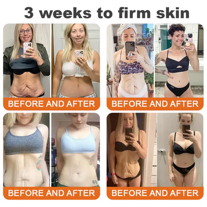 💕FDA Approved:  Bee venom Pro Comprehensive Cream — 🔥Limited Time 80% OFF🔥